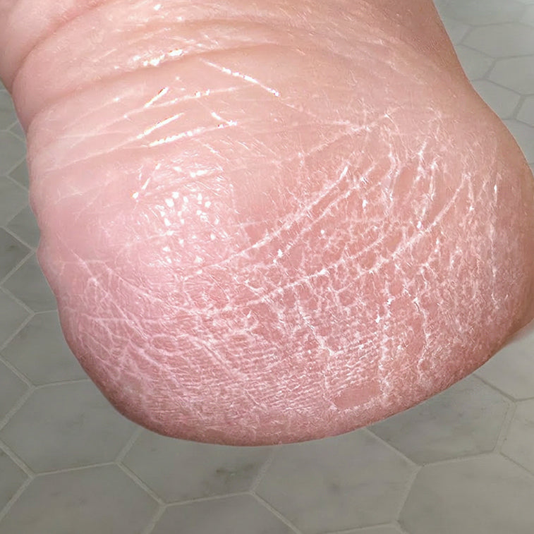 AFTER 4 weeks