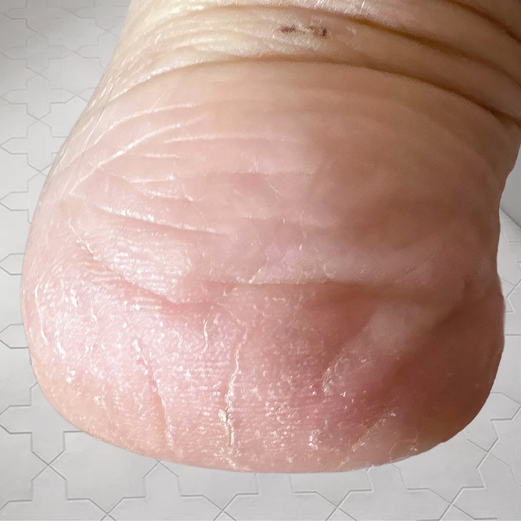 AFTER 4 weeks